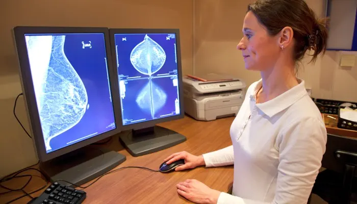 Hallazgos inesperados en imágenes médicas pueden retrasar diagnóstico de cáncer