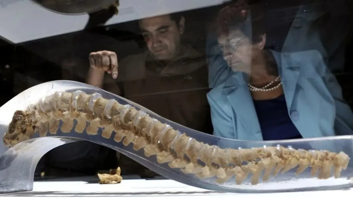 La osteoporosis secundaria: cuando la enfermedad no viene sola