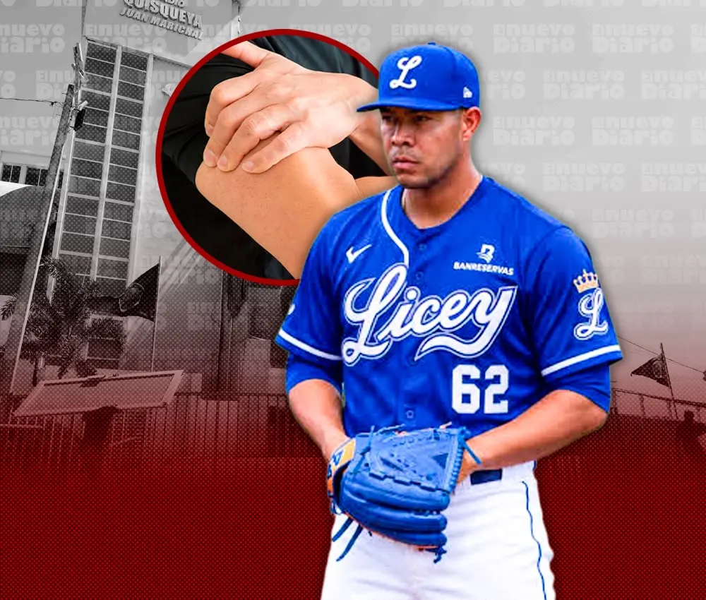 José Quintana se retira del Licey por lesión en el brazo