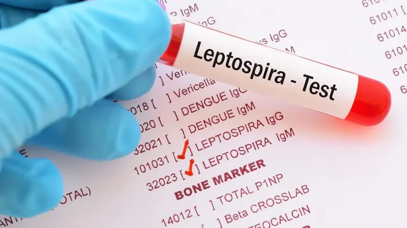Leptospirosis aumenta en 87% y ya hay 20 muertes
